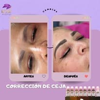 Corrección de ceja antes y después