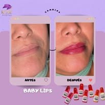 Baby lips antes y después